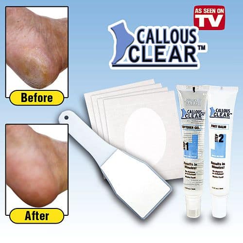 Callous Clear for Rough Dry Feet Callus Remover