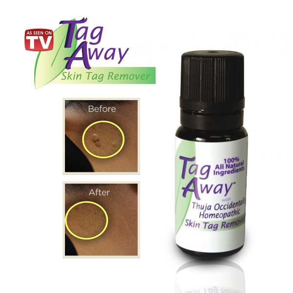 Tag Away Fast Acting Pain-Free Way to Remove Skin Tags